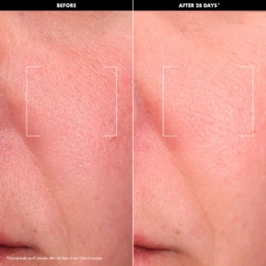 s2882835-av-1202506251609526410700-zoom